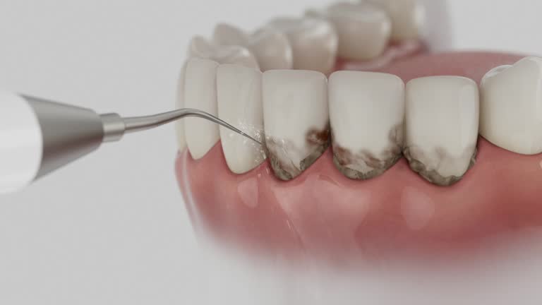 Trusted Teeth Whitening service in Fort Totten, ND - Dentist Open Now